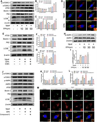 Eicosapentaenoic Acid-Induced Autophagy Attenuates Intervertebral Disc Degeneration by Suppressing Endoplasmic Reticulum Stress, Extracellular Matrix Degradation, and Apoptosis